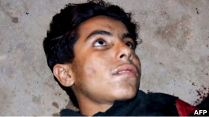 Жилет смертника у Умара Фидаи взорвался неудачно, но на этот случай у него была припасена граната  