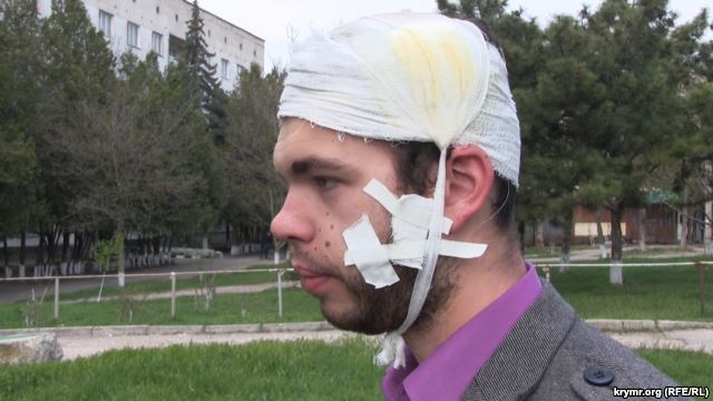 Избитый проукраинский активист Леонид Кузьмин
