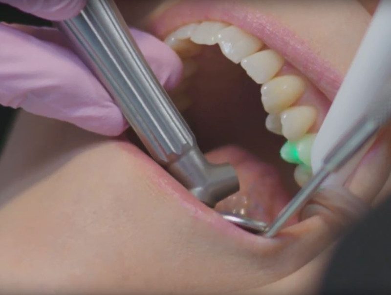 терапевтична стоматологiя