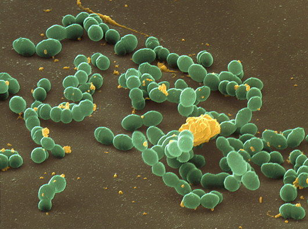 Бактерия «зубного налёта» Streptococcus mutans (фото Eye of Science).