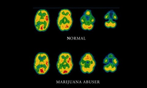 Что делает с мозгом марихуана конопля вредно или полезно