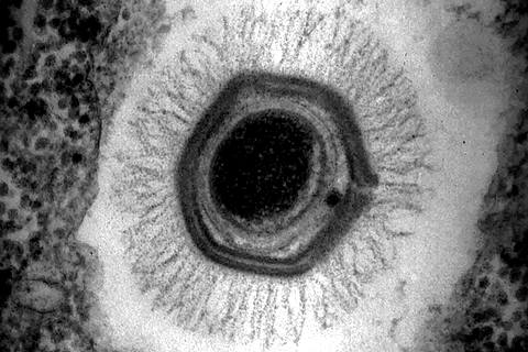 Мимивирус. Фото: jvi.asm.org