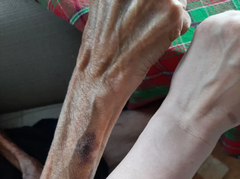 Жительница Мариуполя опубликовала в фейсбуке фотографию руки своего дяди