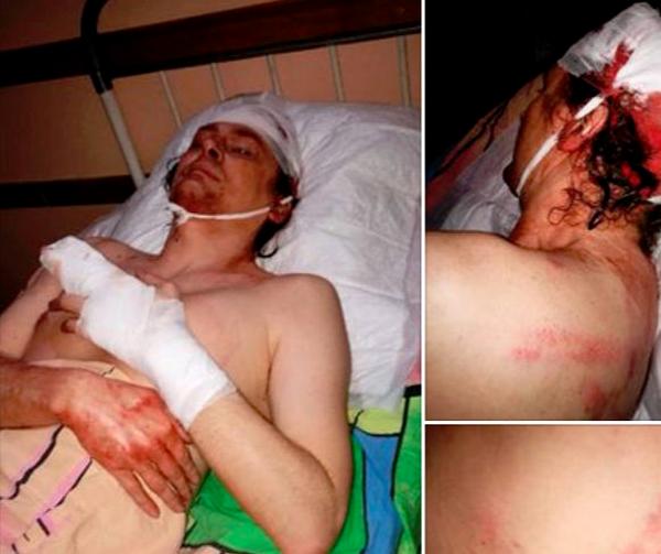 Самые громкие нападения на общественных активистов в Украине за год
