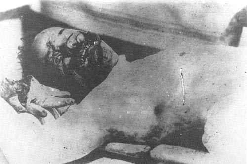 Доктор Беляев, чех. Зверски убит в Верхнеудинске. На фотографии видны отрубленная кисть руки и изуродованное лицо. 