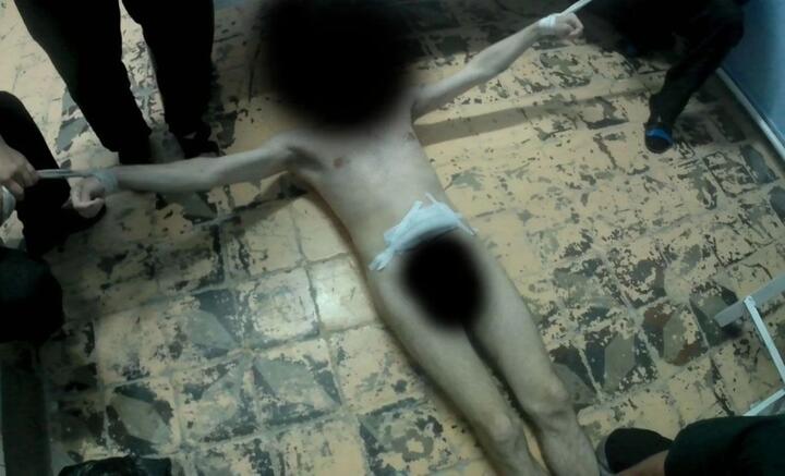 Пытки в областной туберкулезной больнице (ОТБ-1), находящейся в подчинении саратовского УФСИН РФ. Фото: Gulagu.net