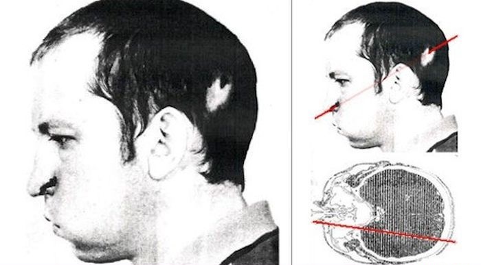 мозг травма наука история отвратительные мужики disgusting men