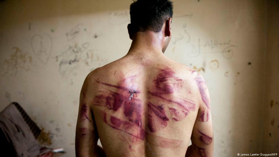 Жертва пыток в сирийской тюрьме